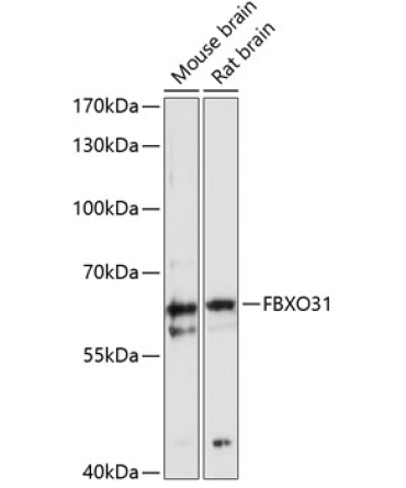 FBXO31 Rabbit Polyclonal Antibody