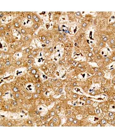 LIF Rabbit Polyclonal Antibody