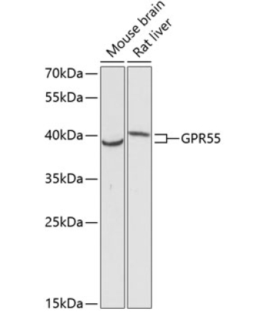 GPR55 Rabbit Polyclonal Antibody