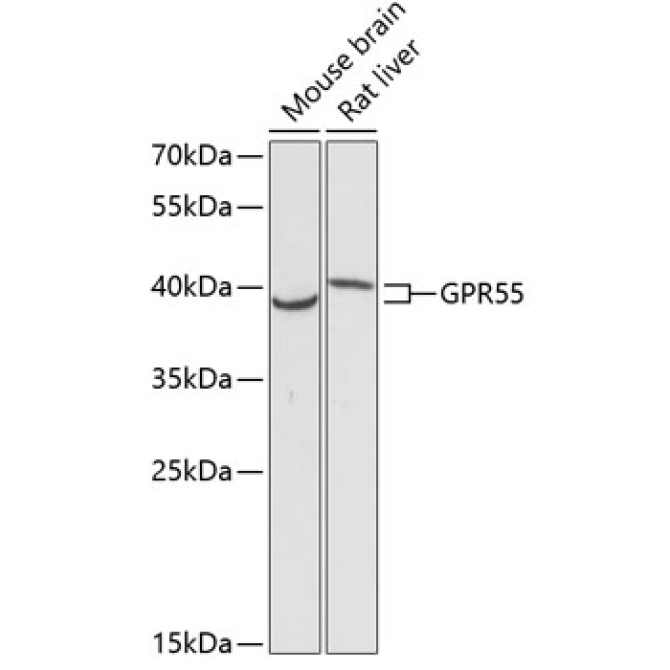 GPR55 Rabbit Polyclonal Antibody