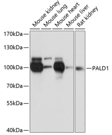 PALD1 Rabbit Polyclonal Antibody