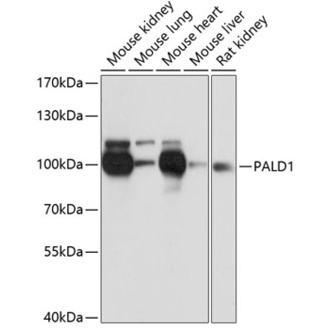 PALD1 Rabbit Polyclonal Antibody