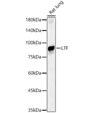 LTF Rabbit Polyclonal Antibody