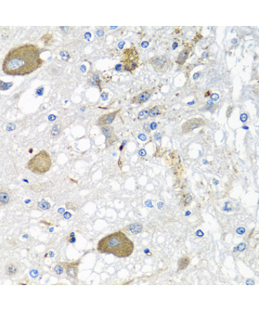 IFNL3 Rabbit Polyclonal Antibody