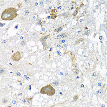 IFNL3 Rabbit Polyclonal Antibody