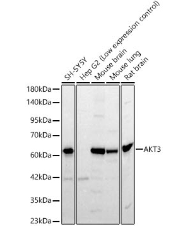 AKT3 Rabbit Polyclonal Antibody