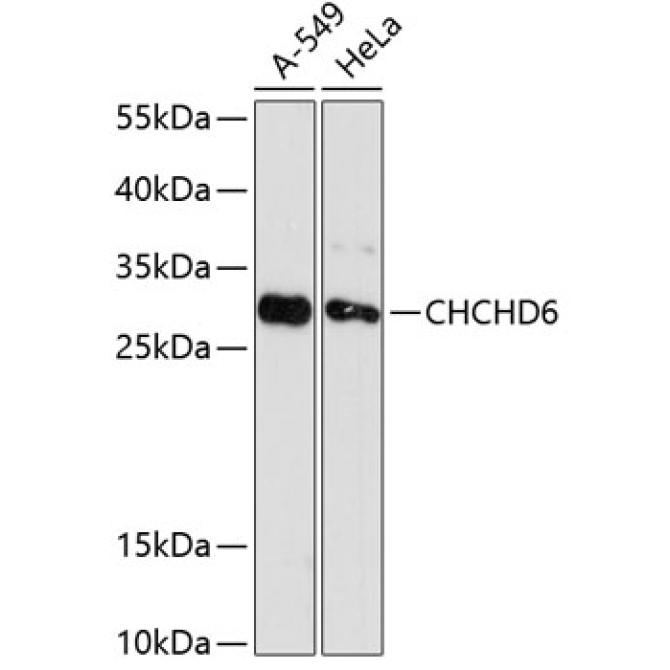 CHCHD6 Rabbit Polyclonal Antibody