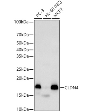 CLDN4 Rabbit Polyclonal Antibody