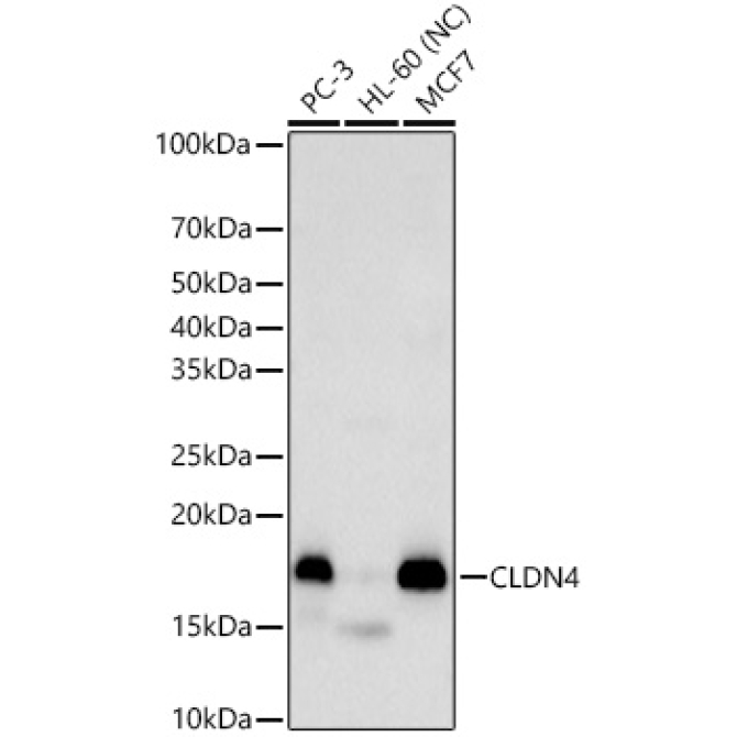 CLDN4 Rabbit Polyclonal Antibody