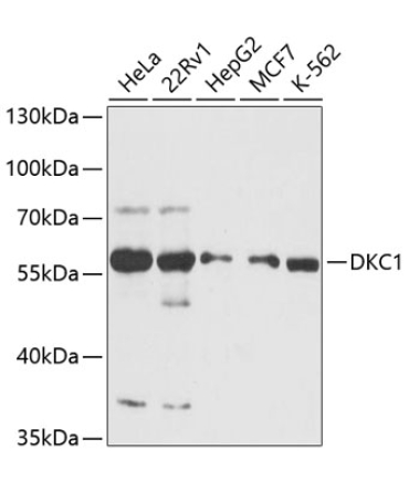 DKC1 Rabbit Polyclonal Antibody