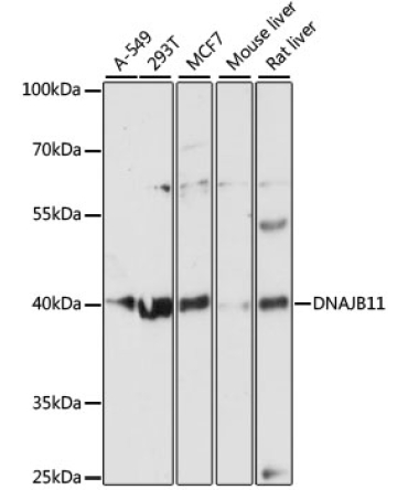 DNAJB11 Rabbit Polyclonal Antibody