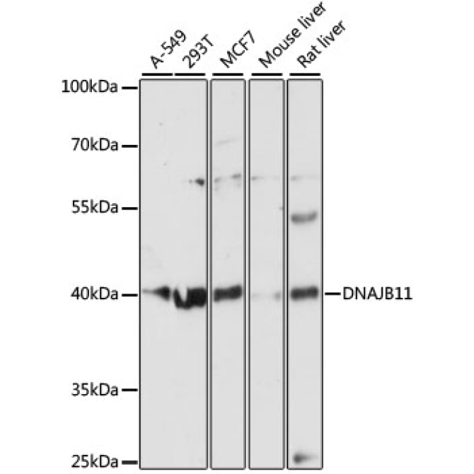 DNAJB11 Rabbit Polyclonal Antibody
