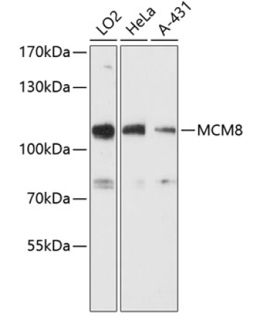 MCM8 Rabbit Polyclonal Antibody