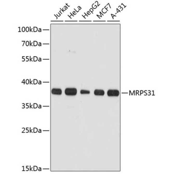 MRPS31 Rabbit Polyclonal Antibody