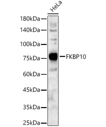 FKBP10 Rabbit Polyclonal Antibody [KO Validated]