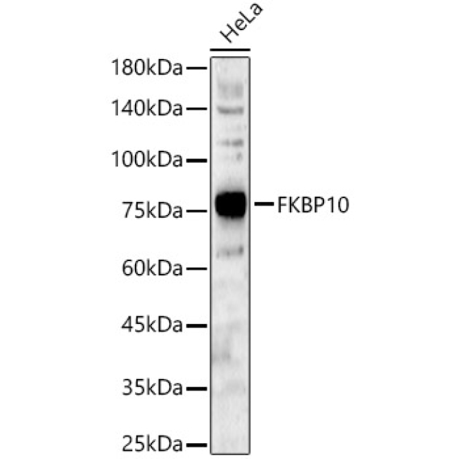 FKBP10 Rabbit Polyclonal Antibody [KO Validated]