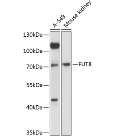 FUT8 Rabbit Polyclonal Antibody