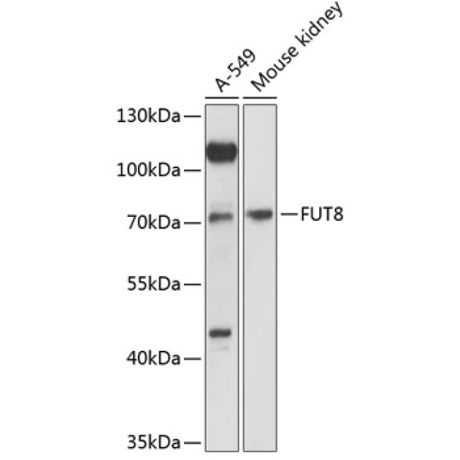 FUT8 Rabbit Polyclonal Antibody