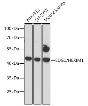 EDG1/HEXIM1 Rabbit Polyclonal Antibody
