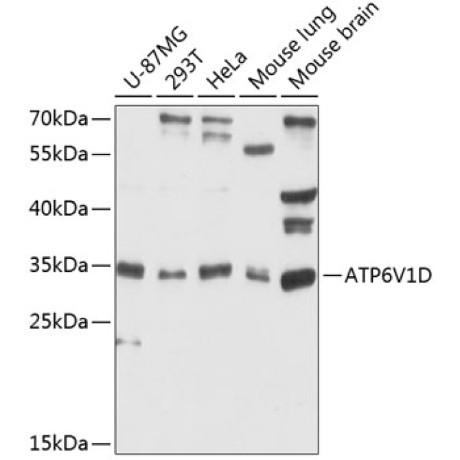 ATP6V1D Rabbit Polyclonal Antibody