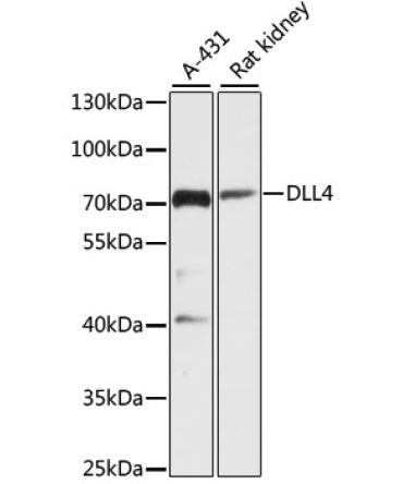 DLL4 Rabbit Polyclonal Antibody