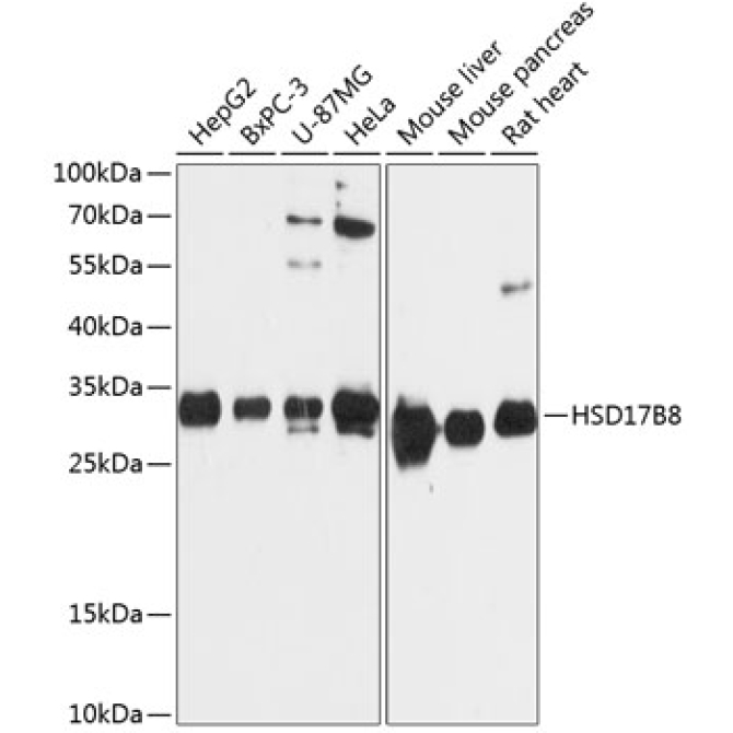HSD17B8 Rabbit Polyclonal Antibody