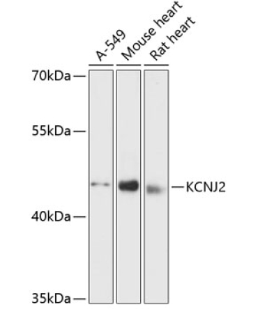 KCNJ2 Rabbit Polyclonal Antibody