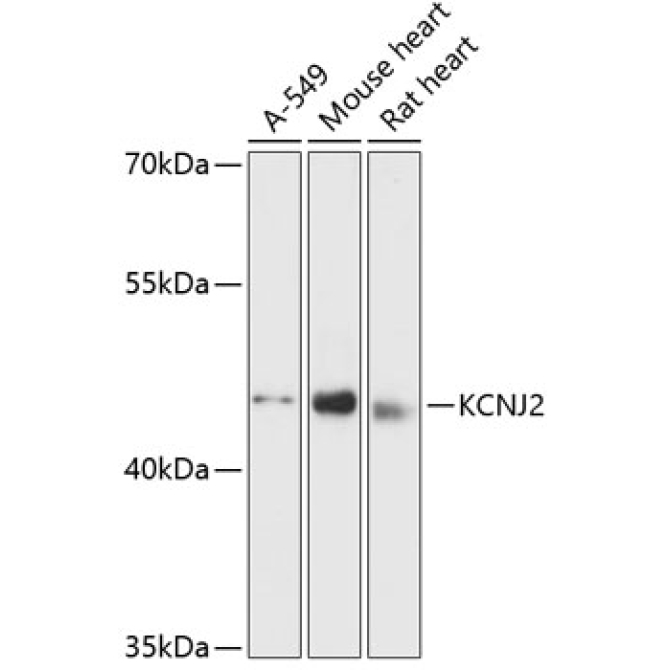 KCNJ2 Rabbit Polyclonal Antibody