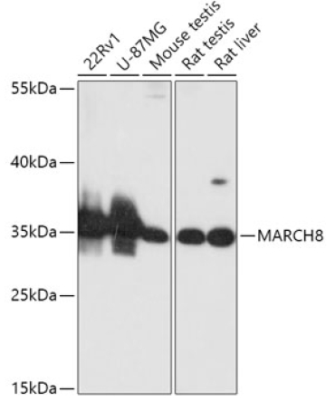 MARCH8 Rabbit Polyclonal Antibody