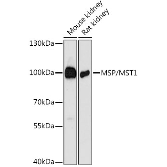 MSP/MST1 Rabbit Polyclonal Antibody