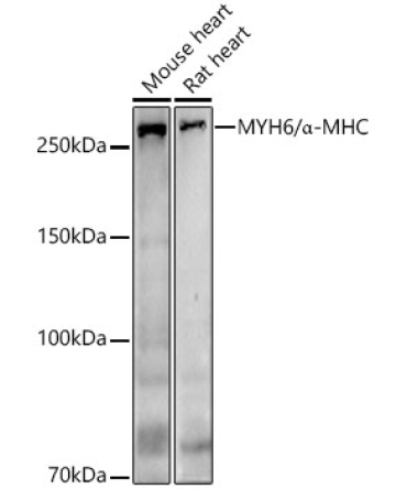 MYH6/Alpha-MHC Rabbit Polyclonal Antibody