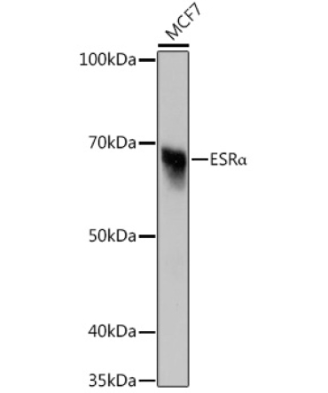 ESRAlpha Rabbit Monoclonal Antibody