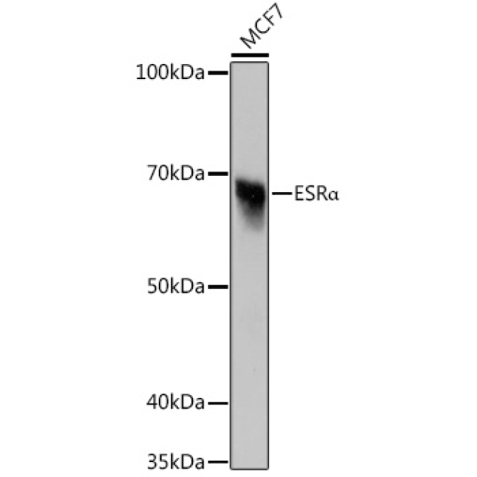 ESRAlpha Rabbit Monoclonal Antibody