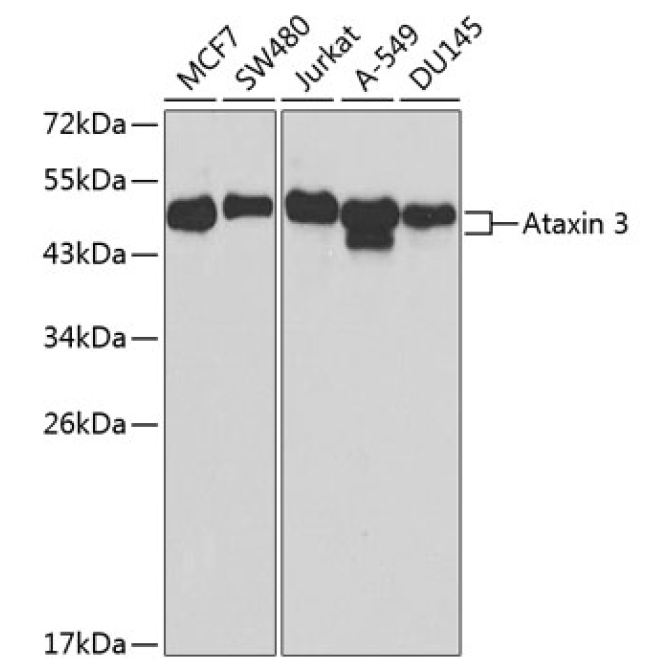 Ataxin-3 (ATXN3) Rabbit Polyclonal Antibody