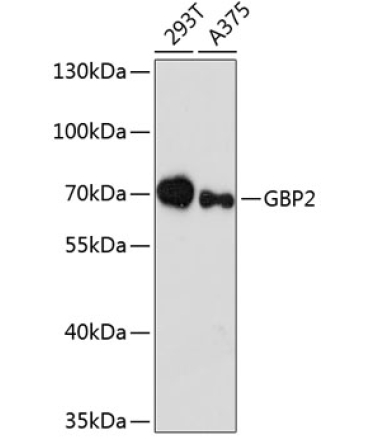 GBP2 Rabbit Polyclonal Antibody
