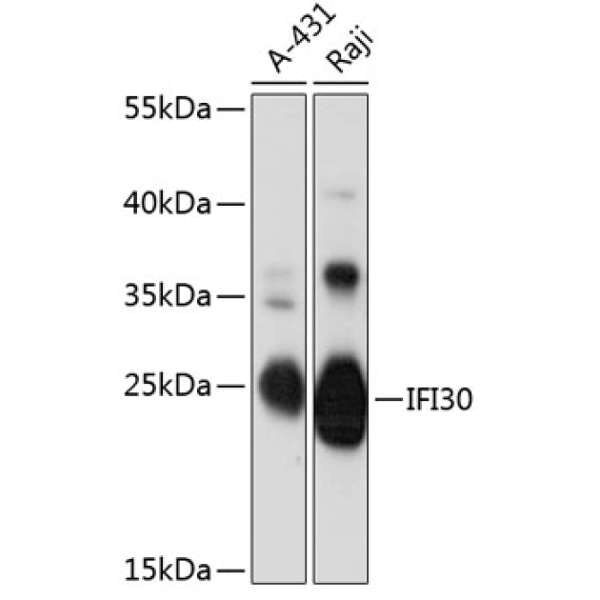IFI30 Rabbit Polyclonal Antibody
