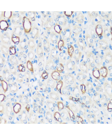 AQP2 Rabbit Polyclonal Antibody