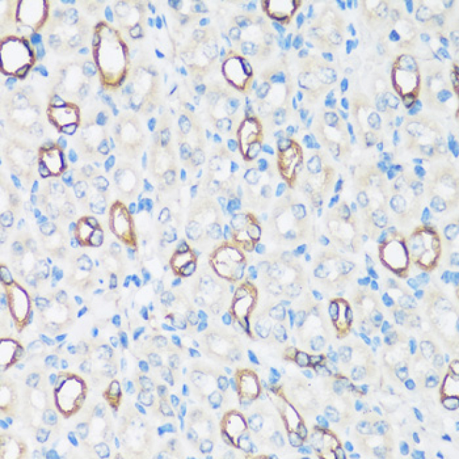 AQP2 Rabbit Polyclonal Antibody