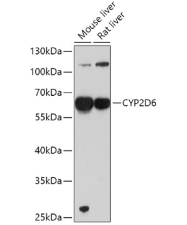 CYP2D6 Rabbit Polyclonal Antibody