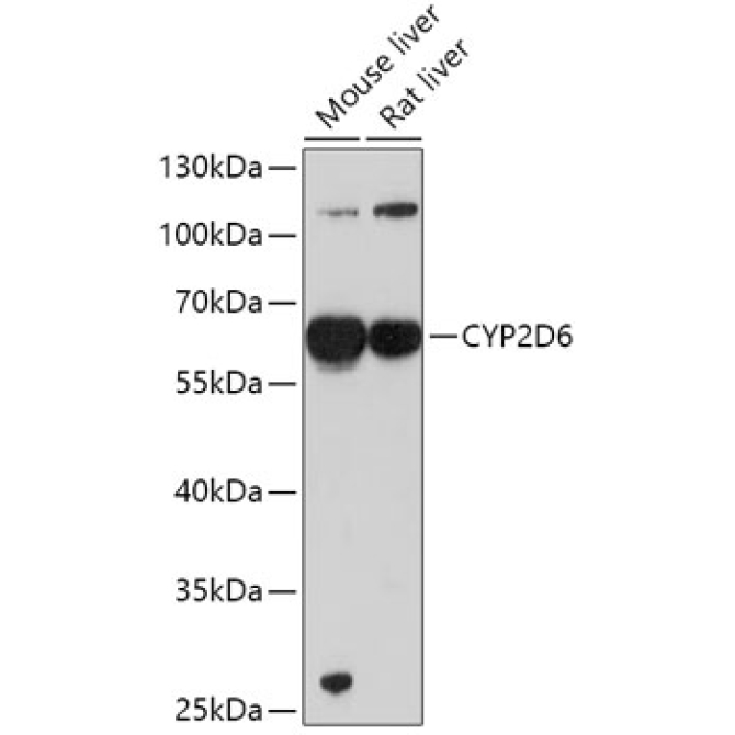 CYP2D6 Rabbit Polyclonal Antibody