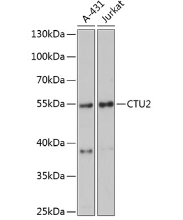CTU2 Rabbit Polyclonal Antibody