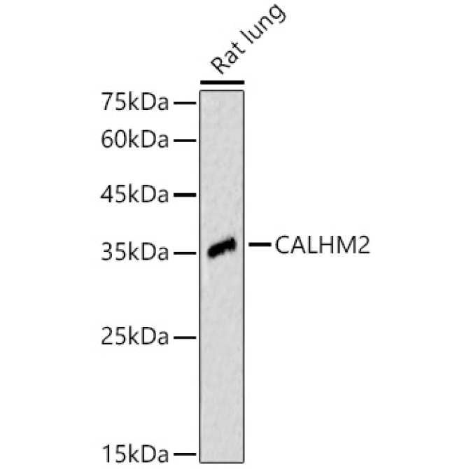 CALHM2 Rabbit Polyclonal Antibody