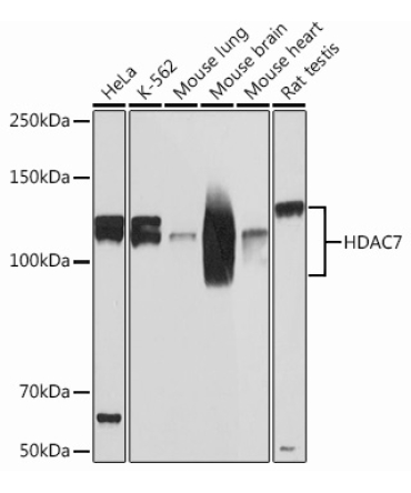 HDAC7 Rabbit Monoclonal Antibody