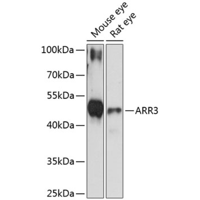 ARR3 Rabbit Polyclonal Antibody