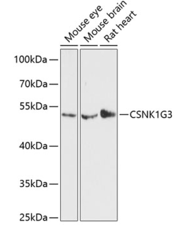 CSNK1G3 Rabbit Polyclonal Antibody