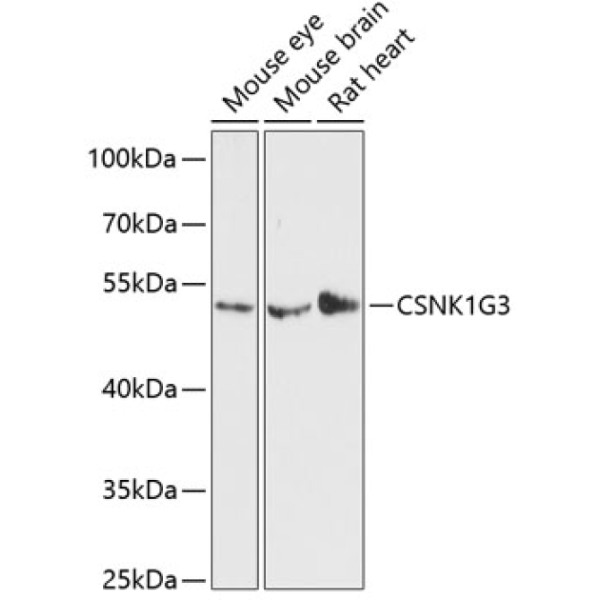 CSNK1G3 Rabbit Polyclonal Antibody