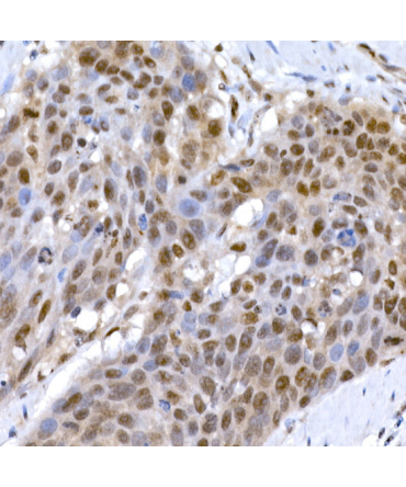 EP300 Rabbit Polyclonal Antibody