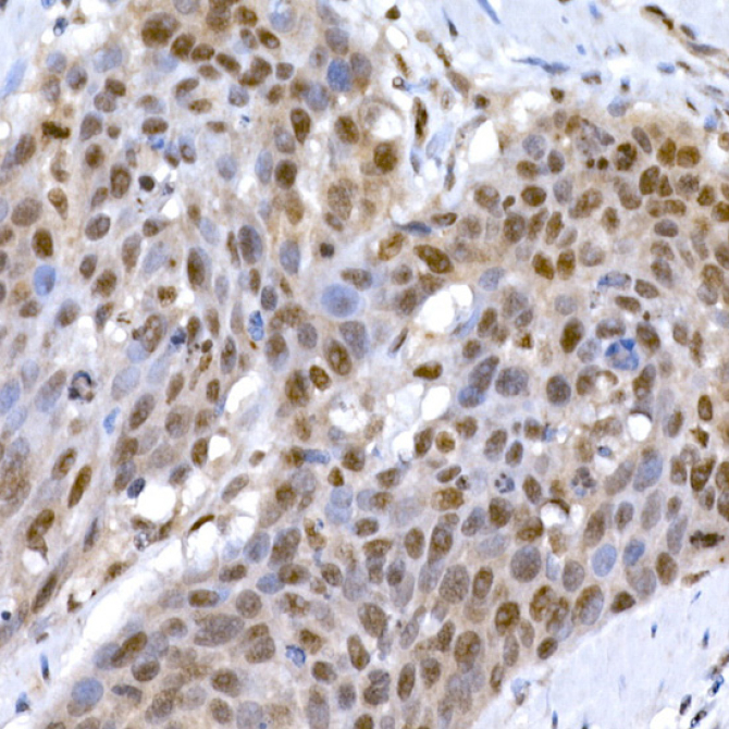 EP300 Rabbit Polyclonal Antibody