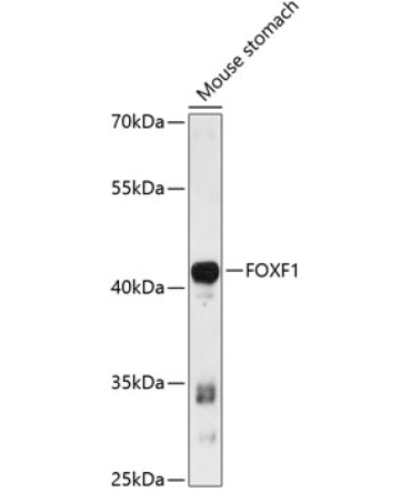 FOXF1 Rabbit Polyclonal Antibody