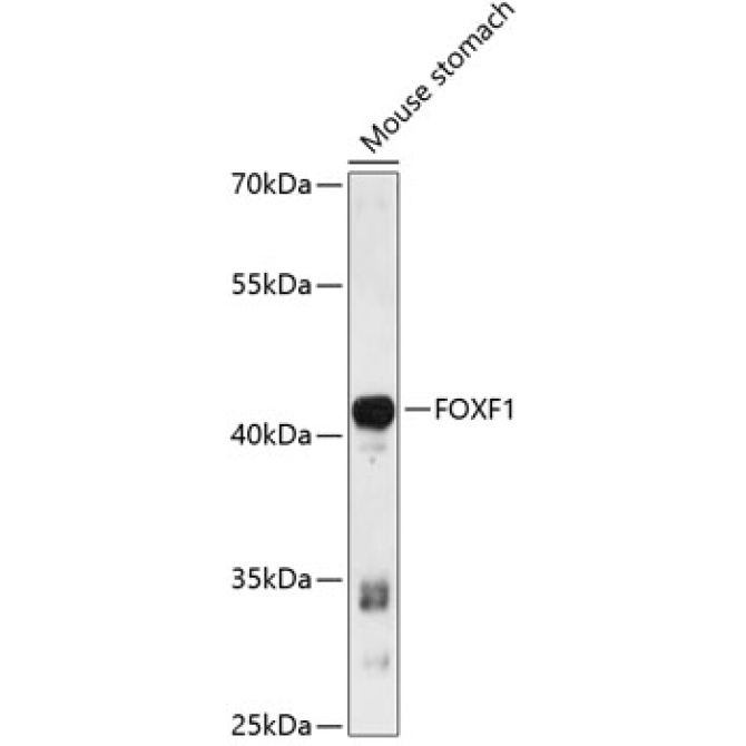 FOXF1 Rabbit Polyclonal Antibody